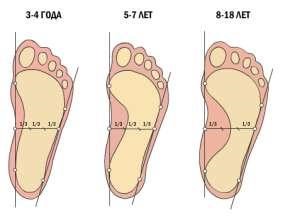 Советы по предупреждению плоскостопия 